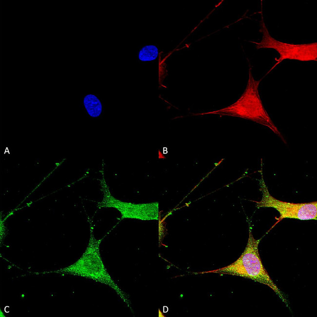 Kir6.1 (KCNJ8) Antibody in Immunocytochemistry (ICC/IF)