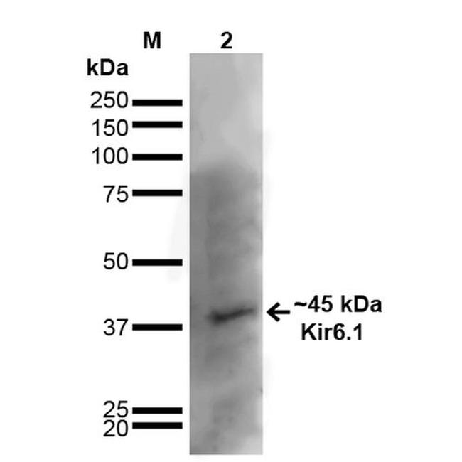 Kir6.1 (KCNJ8) Antibody in Western Blot (WB)