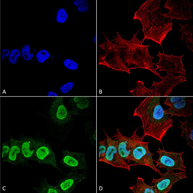 alpha Synuclein Antibody in Immunocytochemistry (ICC/IF)