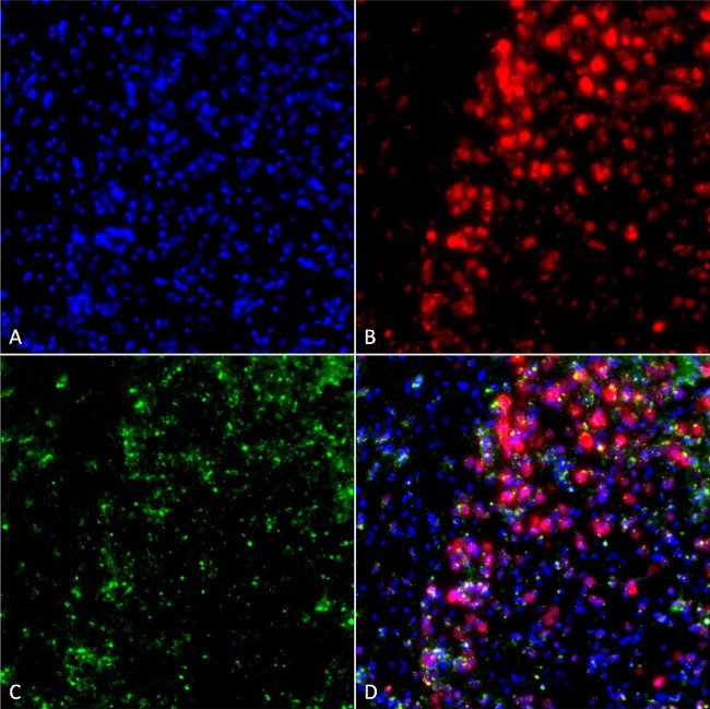 alpha Synuclein Antibody in Immunocytochemistry (ICC/IF)