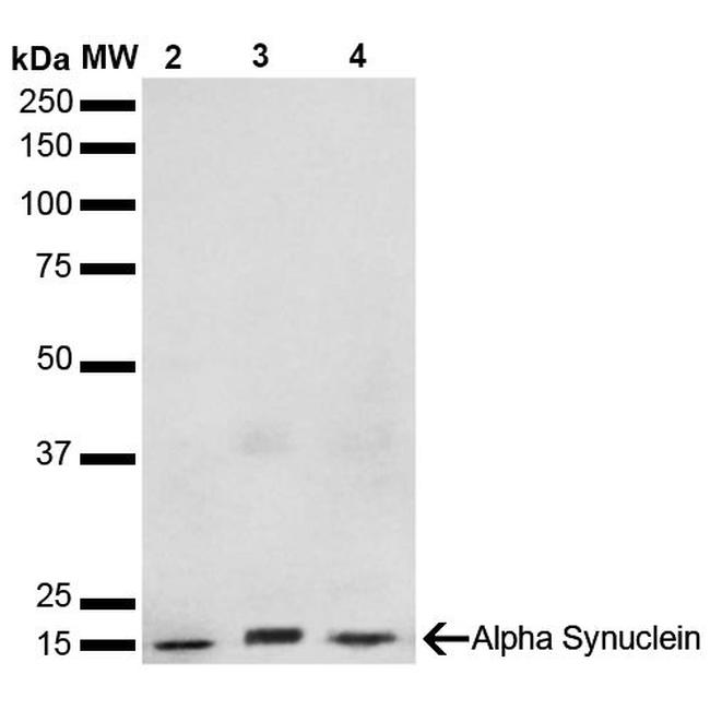 alpha Synuclein Antibody in Western Blot (WB)