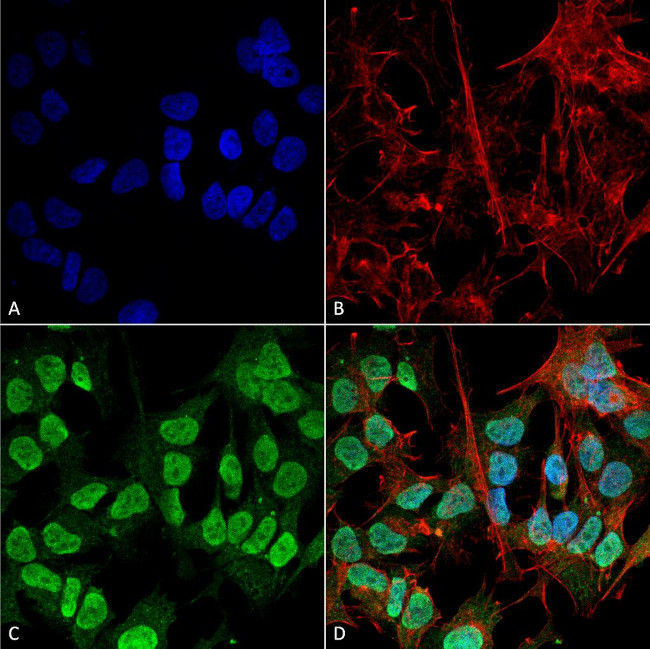 alpha Synuclein Antibody in Immunocytochemistry (ICC/IF)