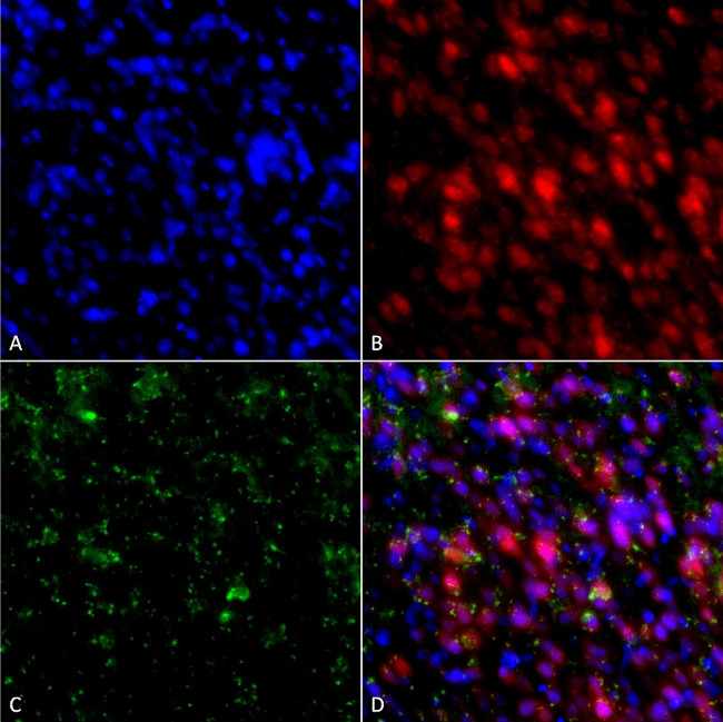 alpha Synuclein Antibody in Immunocytochemistry (ICC/IF)