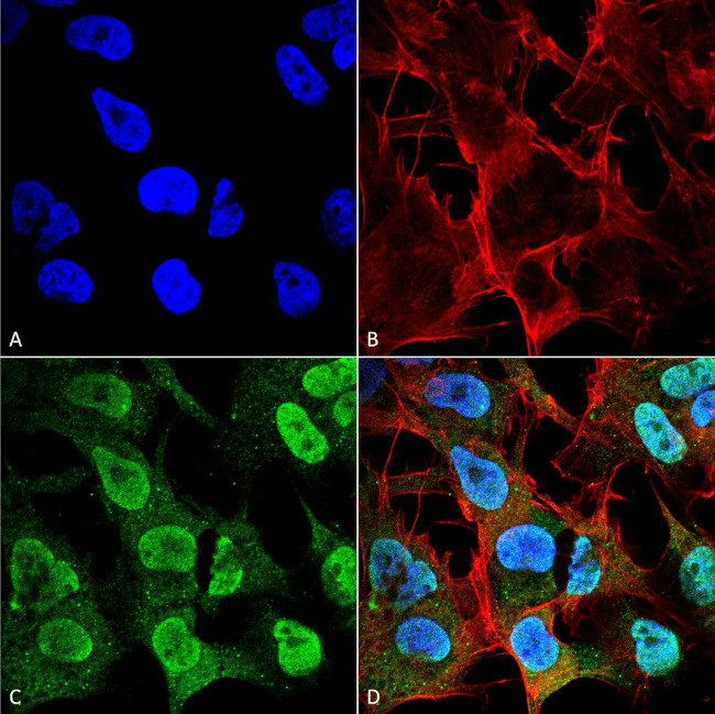 alpha Synuclein Antibody in Immunocytochemistry (ICC/IF)