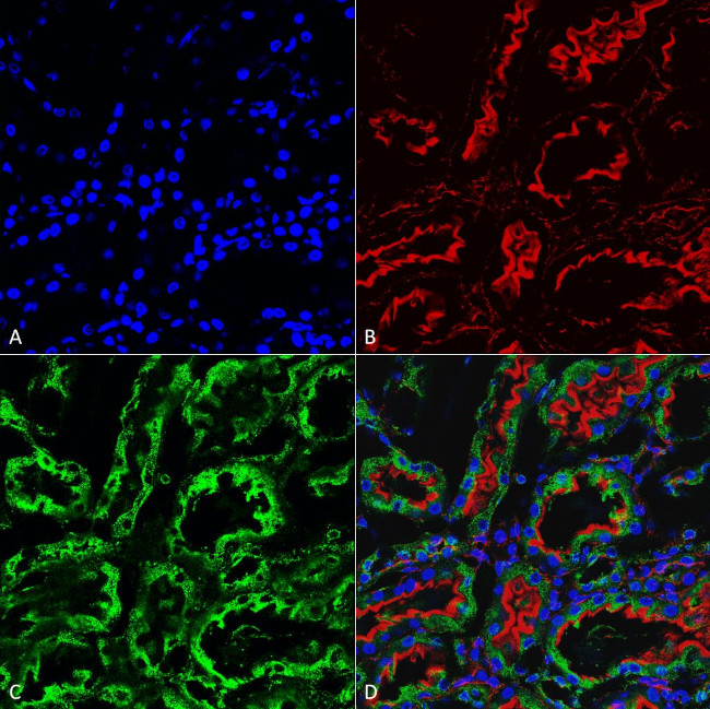 KDEL Antibody in Immunohistochemistry (Paraffin) (IHC (P))