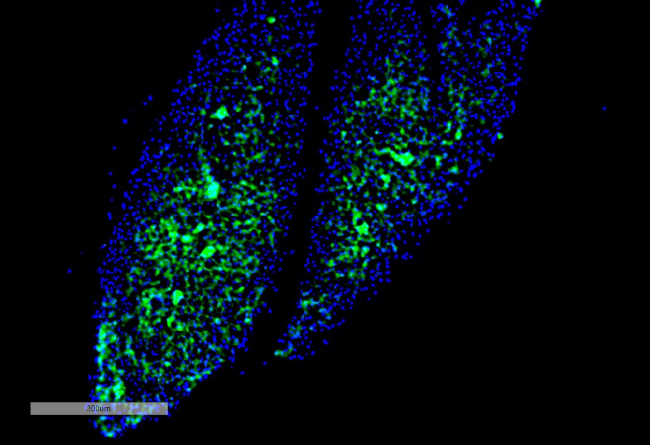 THRA/THRB Antibody in Immunohistochemistry (IHC)