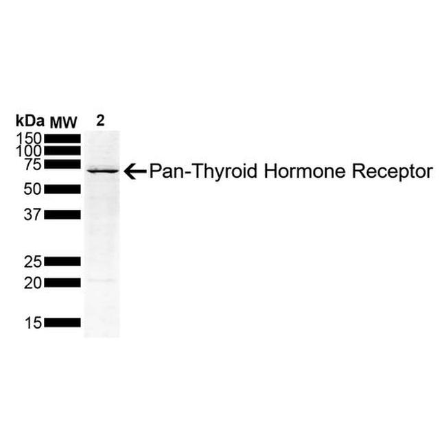 THRA/THRB Antibody in Western Blot (WB)