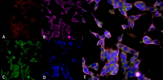 Parvalbumin Antibody in Immunocytochemistry (ICC/IF)