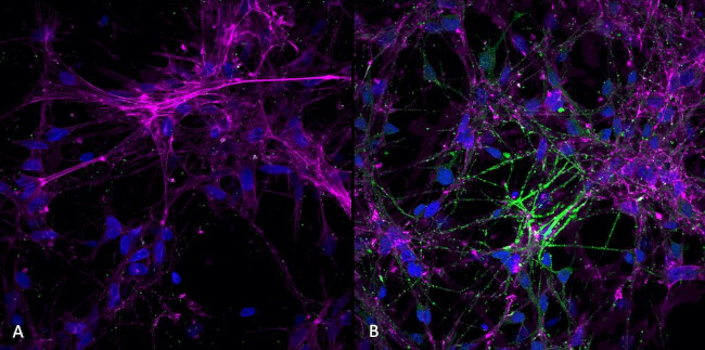 Phospho-alpha Synuclein (Ser129) Antibody in Immunocytochemistry (ICC/IF)