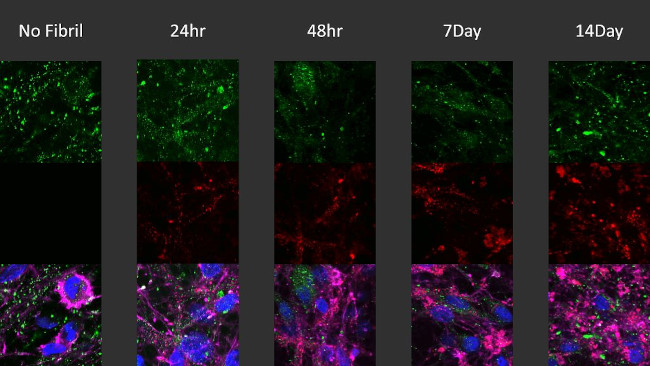 Phospho-alpha Synuclein (Ser129) Antibody in Immunocytochemistry (ICC/IF)