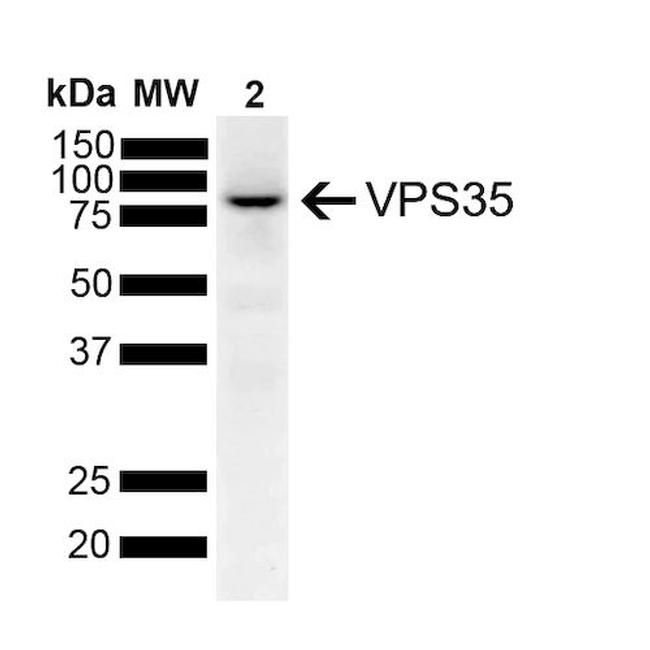 VPS35 Antibody in Western Blot (WB)