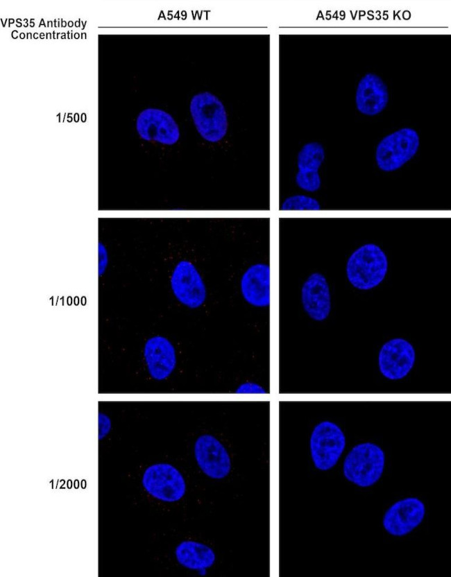 VPS35 Antibody in Immunocytochemistry (ICC/IF)