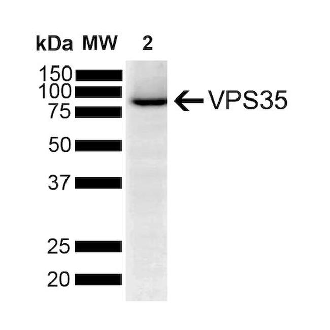 VPS35 Antibody in Western Blot (WB)