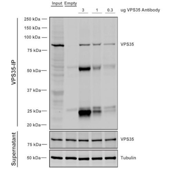 VPS35 Antibody in Immunoprecipitation (IP)