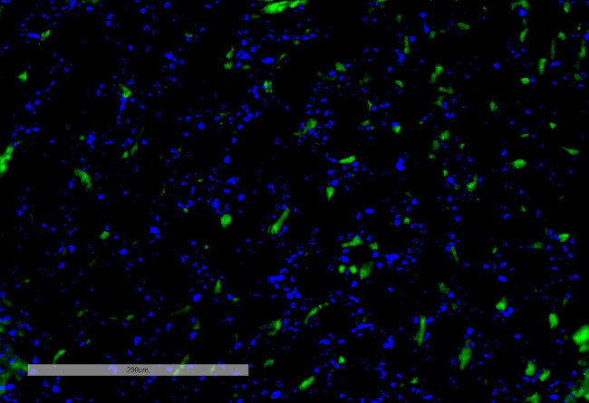 VPS35 Antibody in Immunohistochemistry (IHC)