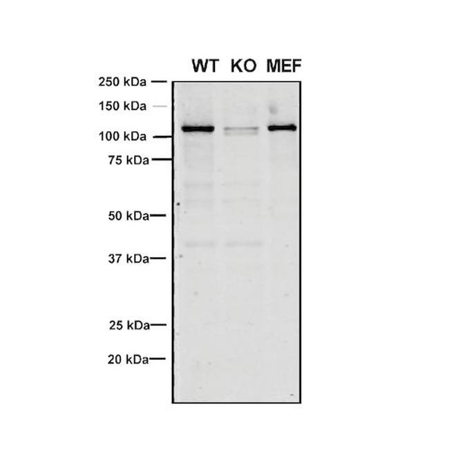 VPS35 Antibody in Western Blot (WB)