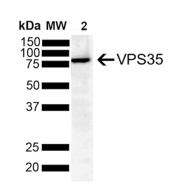 VPS35 Antibody in Western Blot (WB)