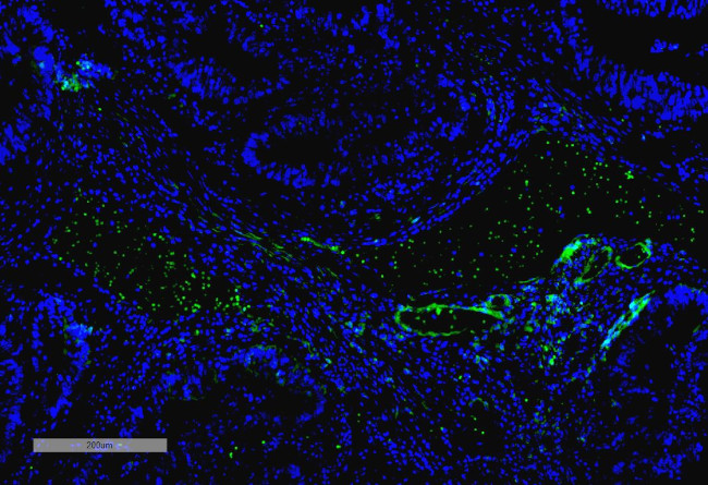 VPS35 Antibody in Immunohistochemistry (IHC)