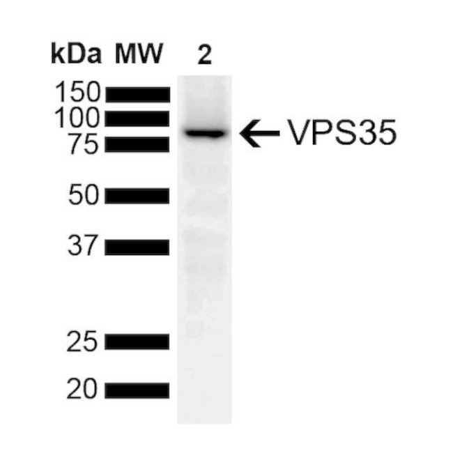 VPS35 Antibody in Immunoprecipitation (IP)