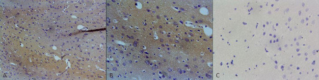 nNOS Antibody in Immunohistochemistry (IHC)