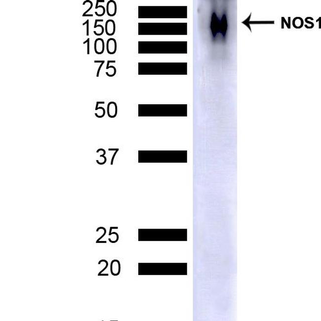 nNOS Antibody in Western Blot (WB)