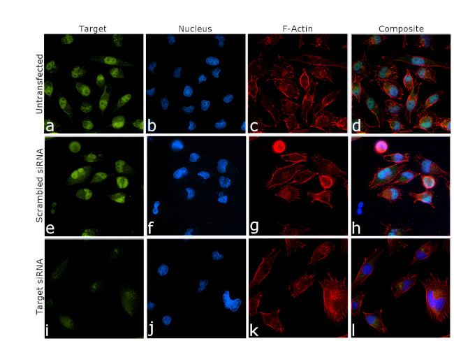 JMJD1B Antibody