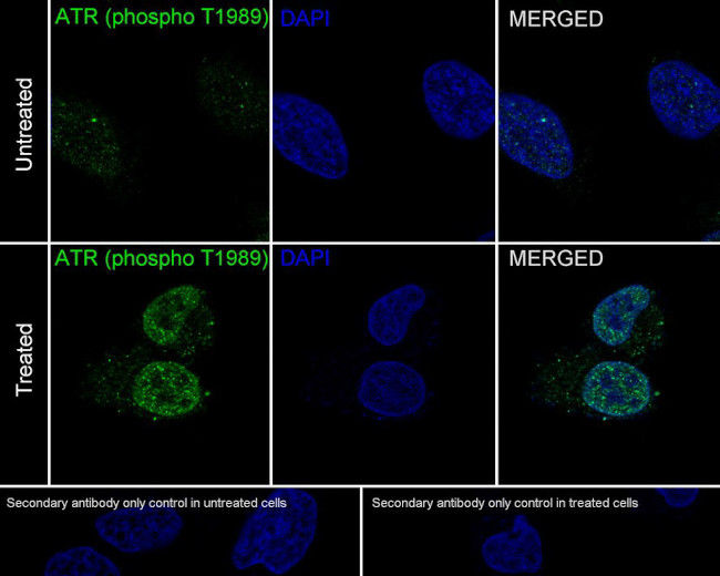 Phospho-ATR (Thr1989) Antibody in Immunocytochemistry (ICC/IF)
