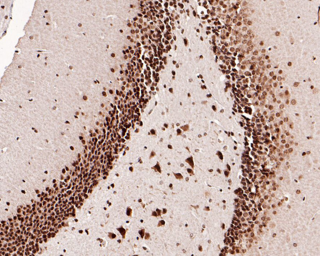 SETD1A Antibody in Immunohistochemistry (Paraffin) (IHC (P))