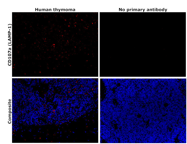 LAMP1 Antibody in Immunohistochemistry (Paraffin) (IHC (P))