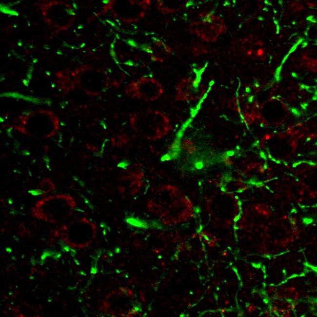 LAMP1 Antibody in Immunohistochemistry (Paraffin) (IHC (P))