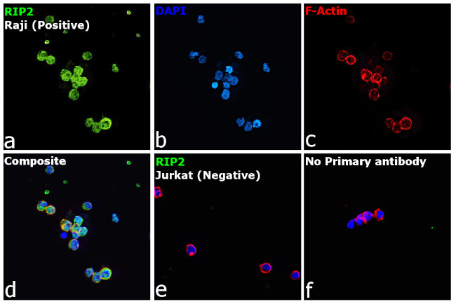 RIP2 Antibody in Immunocytochemistry (ICC/IF)