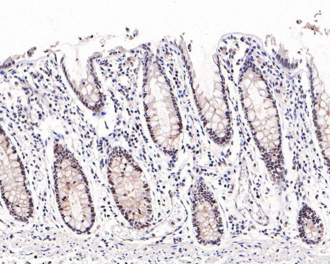 EZH1 Antibody in Immunohistochemistry (Paraffin) (IHC (P))