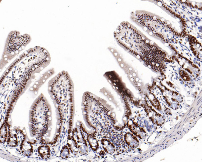 EZH1 Antibody in Immunohistochemistry (Paraffin) (IHC (P))