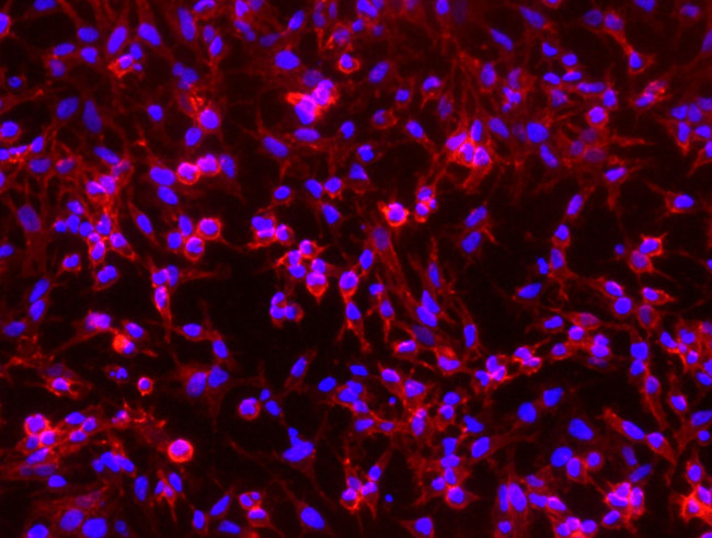 CD146 Antibody in Immunocytochemistry (ICC/IF)