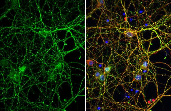 Phospo-Tau (Thr217) Antibody in Immunocytochemistry (ICC/IF)