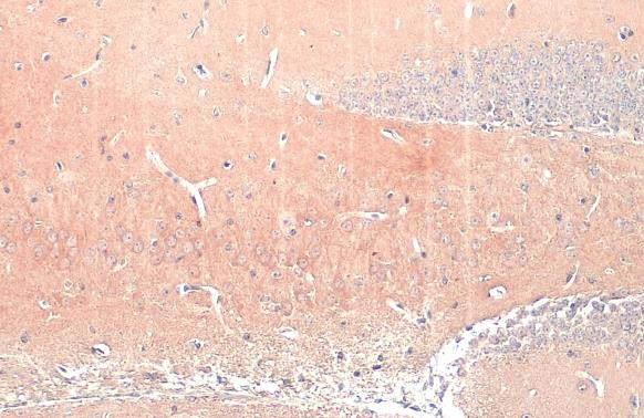 Phospo-Tau (Thr217) Antibody in Immunohistochemistry (Paraffin) (IHC (P))