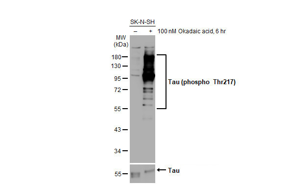 Phospo-Tau (Thr217) Antibody in Western Blot (WB)