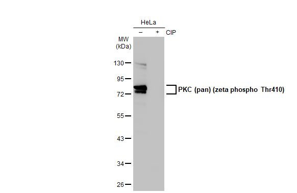 Phospho-PKC zeta (Thr410) Antibody in Western Blot (WB)