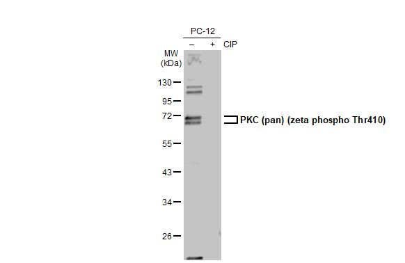 Phospho-PKC zeta (Thr410) Antibody in Western Blot (WB)