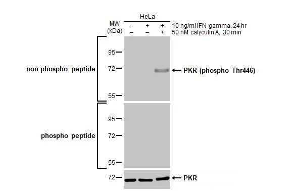 Phospho-PKR (Thr446) Antibody in Western Blot (WB)