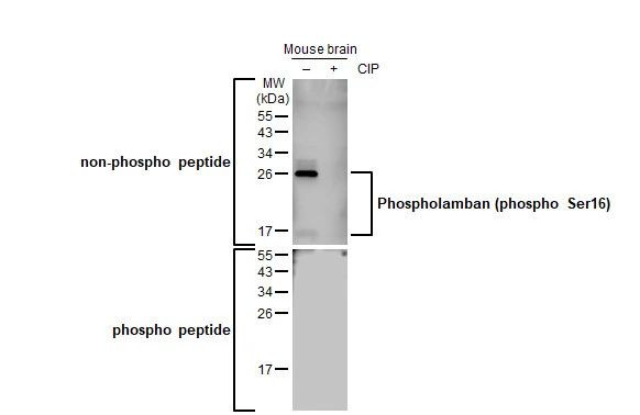 Phospho-Phospholamban (Ser16) Antibody in Western Blot (WB)