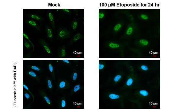 Phospho-ATR (Thr1989) Antibody in Immunocytochemistry (ICC/IF)