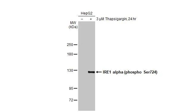 Phospho-IRE1 alpha (Ser724) Antibody in Western Blot (WB)