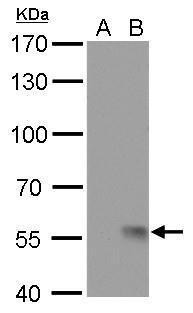 Influenza A H1N1 NA (A/WSN/1933) Antibody in Western Blot (WB)