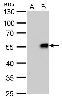 Influenza A H1N1 NA (A/WSN/1933) Antibody in Western Blot (WB)