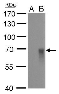 Influenza A H1N1 HA (A/WSN/1933) Antibody in Western Blot (WB)