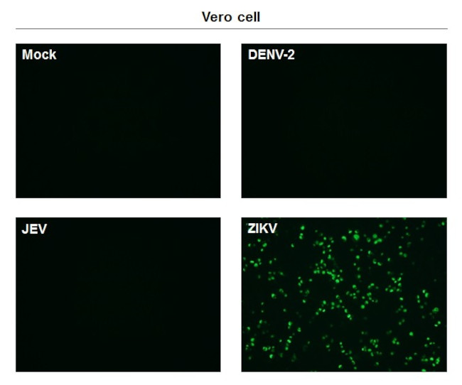 Zika Virus NS1 (strain H/PF/2013) Antibody in Immunocytochemistry (ICC/IF)