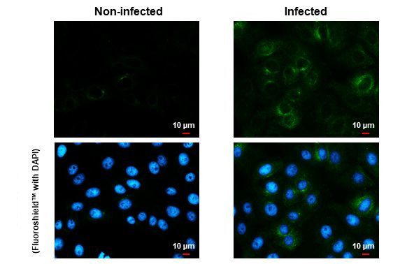 Zika Virus NS1 (strain H/PF/2013) Antibody in Immunocytochemistry (ICC/IF)