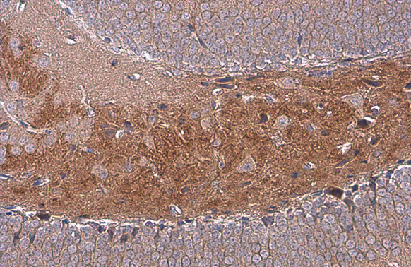 C9orf72 Antibody in Immunohistochemistry (Paraffin) (IHC (P))