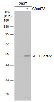 C9orf72 Antibody in Western Blot (WB)